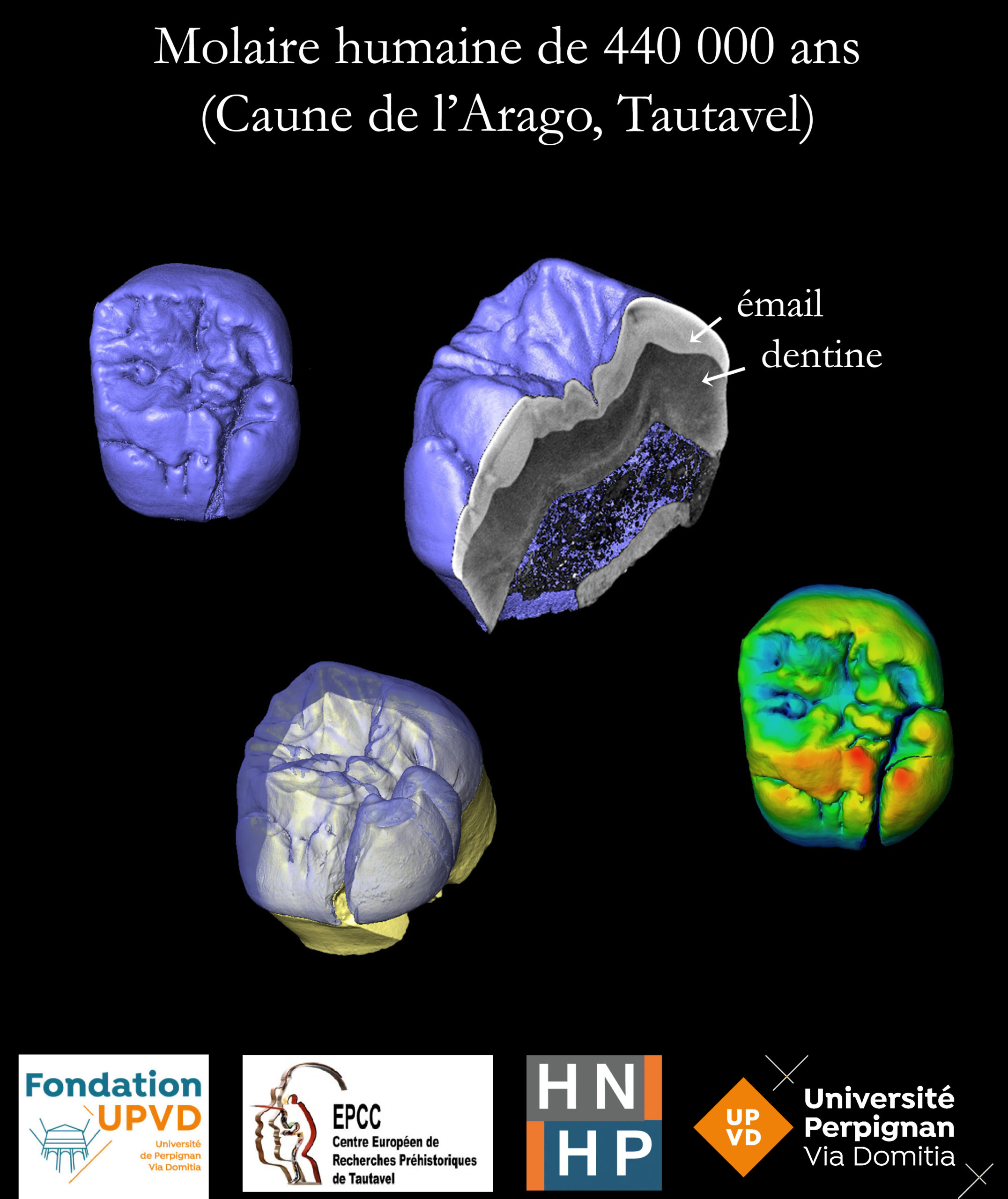 Numérisation du patrimoine fossile humain de la région Occitanie pour la conservation et la recherche.